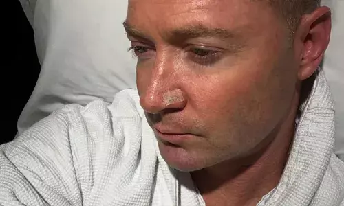 പ്രതിരോധമാണ് ചികിത്സയെക്കാൾ ഉത്തമം; മുൻ ഓസീസ് നായകൻ മൈക്കിൾ ക്ലാർക്കിന് വീണ്ടും ചർമാർബുദം; ജാഗ്രത വേണമെന്ന് മുന്നറിയിപ്പുമായി താരം