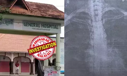 തൈറോയ്ഡ് ശസ്ത്രക്രിയയ്ക്കിടെ നെഞ്ചില്‍ സര്‍ജിക്കല്‍ ട്യൂബ് കുടുങ്ങി; കാട്ടാക്കട സ്വദേശിയായ യുവതിയുടെ സംസാരശേഷി പോയി;  മാറ്റാന്‍ പ്രയാസമെന്നും ശ്രമിച്ചാല്‍ ജീവന് ഭീഷണിയെന്നും ഡോക്ടര്‍ അറിയിച്ചു;   തിരുവനന്തപുരം ജനറല്‍ ആശുപത്രിയില്‍ ഗുരുതര ചികിത്സാ പിഴവെന്ന് ആരോപണം