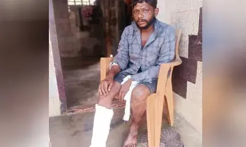 റോഡിലേക്ക് ചാടിയ കാട്ടുപന്നികള്‍ ദേഹത്തേക്ക് വീണു; യുവാവിന്റെ കാലിന് പരിക്ക്‌