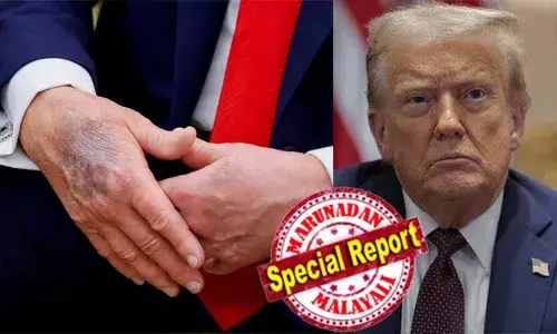 താന്‍ കടന്നുപോകുന്നത് ജീവിതത്തിലെ ഏറ്റവും നല്ല ആരോഗ്യ സ്ഥിതിയിലൂടെ; ഗുരുതര ആരോഗ്യ പ്രശ്‌നമെന്ന റിപ്പോര്‍ട്ടുകള്‍ തള്ളി ഡൊണാള്‍ഡ് ട്രംപ്;  കൈകളിലെ കറുത്ത ചതവുകളുടെയും വീര്‍ത്ത കണങ്കാലുകളും പ്രശ്‌നമില്ലെന്ന് പറഞ്ഞ് അവഗണിച്ചു അമേരിക്കന്‍ പ്രസിഡന്റ്