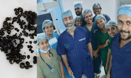 യുവതിയുടെ പിത്താശയത്തില്‍ നിന്നും നീക്കിയത് 222 കല്ലുകള്‍; അടൂര്‍ ലൈഫ് ലൈന്‍ ആശുപത്രിയില്‍ നടന്നത് അപൂര്‍വ ലാപ്രോസ്‌കോപ്പിക് കോളിസിസ്റ്റെക്ടമി  ശസ്ത്രക്രിയ