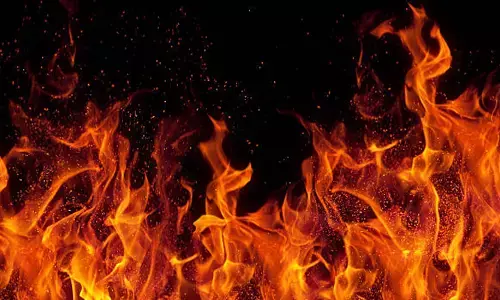 എലി കടിച്ച് കാൽ മുറിച്ചുമാറ്റിയത് കഴിഞ്ഞ ജൂണിൽ; ഡ്രൈവറായി ജോലി ചെയ്യവേ ജീവിതം ദുരന്തപൂർണമായി; ഒടുവിൽ അവശ നിലയിലായ 51-കാരൻ പെട്രോൾ ഒഴിച്ച് ജീവനൊടുക്കി