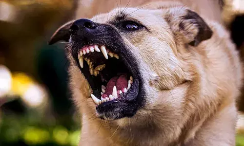 നായ കടിച്ചാൽ പിന്നെ കാണിക്കുന്നത് വിചിത്രമായ പ്രവർത്തികൾ; ഈ ലക്ഷണങ്ങൾ നിങ്ങൾ ഒരിക്കലും അവഗണിക്കരുത്; പ്രധാനമായും അറിഞ്ഞിരിക്കേണ്ട 5 കാര്യങ്ങൾ അറിയാം...