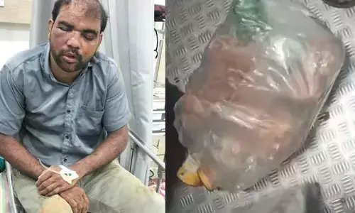 ടിടിഇ ടിക്കറ്റ് ആവശ്യപ്പെട്ടപ്പോൾ സ്വഭാവം മാറി; ഒന്നും നോക്കാതെ ട്രെയിനിൽ നിന്ന് ശീതളപാനീയ കച്ചവടക്കാരന്‍ എടുത്തു ചാടി; മുഖത്ത് പരിക്ക്; രക്ഷപ്പെട്ടത് ഭാഗ്യം കൊണ്ട്