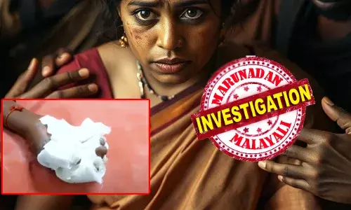 യുവതിക്ക് ഭര്‍ത്താവിനോട് വിശ്വസ്തതയില്ല; നാത്തൂന്റെ സംശയം മാറ്റാന്‍ അഗ്‌നിപരീക്ഷയല്ലാതെ മറ്റ് മാര്‍ഗ്ഗമില്ല; ഭര്‍ത്താവിന്റെയും സഹോദരിയുടെയും ക്രൂരതയില്‍ 31കാരിക്ക് ഗുരുതര പരിക്ക്; വീഡിയോ ദൃശ്യങ്ങള്‍ പ്രചരിച്ചതോടെ പാതിവ്രത്യം തെളിയിക്കാനിറങ്ങിയവര്‍ മുങ്ങി