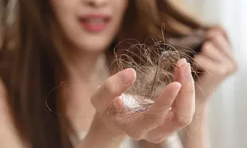 നിങ്ങൾക്ക് തലമുടി കൊഴിച്ചിൽ ഉണ്ടോ?; എങ്കിൽ ഈ ഭക്ഷണങ്ങള്‍ പെട്ടെന്ന് ഒഴിവാക്കിക്കോ..; അറിയാം