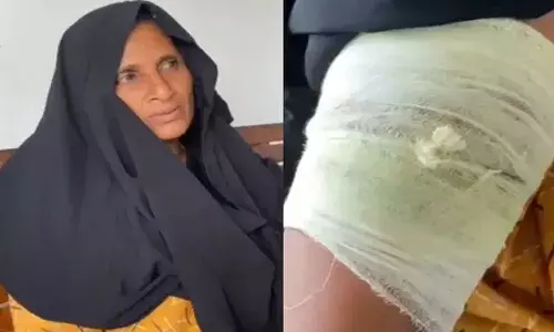 കാട്ടുപന്നി ശല്യം; നഗരസഭാ കവാടത്തില്‍ സമരം ചെയ്ത് വീട്ടിലെത്തിയ സ്ത്രീക്ക് നേരെ കാട്ടുപന്നി ആക്രമണം: തോളെല്ലിനും കാലിനും പരിക്ക്