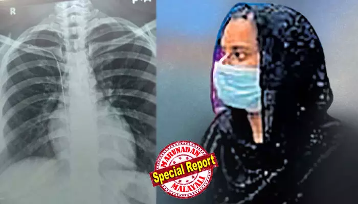 ശസ്ത്രക്രിയയ്ക്കിടെ നെഞ്ചില്‍ കുടുങ്ങിയ ഗൈഡ് വയറിന്റെ രണ്ടറ്റവും ധമനികളില്‍ ഒട്ടിച്ചേര്‍ന്നു; കീഹോള്‍ ശസ്ത്രക്രിയ രണ്ട് തവണയും പരാജയം;  മേജര്‍ ശസ്ത്രക്രിയ വേണ്ടിവരുമെന്ന് ഡോക്ടര്‍മാര്‍; താല്‍പര്യമില്ലെന്ന നിലപാടില്‍ യുവതിയുടെ കുടുംബം