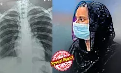 ശസ്ത്രക്രിയയ്ക്കിടെ നെഞ്ചില് കുടുങ്ങിയ ഗൈഡ് വയറിന്റെ രണ്ടറ്റവും ധമനികളില് ഒട്ടിച്ചേര്ന്നു; കീഹോള് ശസ്ത്രക്രിയ രണ്ട് തവണയും പരാജയം; മേജര് ശസ്ത്രക്രിയ വേണ്ടിവരുമെന്ന് ഡോക്ടര്മാര്; താല്പര്യമില്ലെന്ന നിലപാടില് യുവതിയുടെ കുടുംബം ശസ്ത്രക്രിയയ്ക്കിടെ നെഞ്ചില് കുടുങ്ങിയ ഗൈഡ് വയറിന്റെ രണ്ടറ്റവും ധമനികളില് ഒട്ടിച്ചേര്ന്നു; കീഹോള് ശസ്ത്രക്രിയ രണ്ട് തവണയും പരാജയം; മേജര് ശസ്ത്രക്രിയ വേണ്ടിവരുമെന്ന് ഡോക്ടര്മാര്; താല്പര്യമില്ലെന്ന നിലപാടില് യുവതിയുടെ കുടുംബം