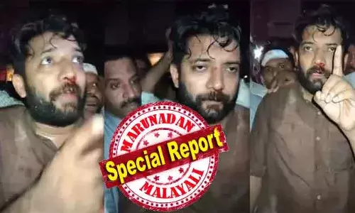 ഷാഫിയുടെ മുക്കെല്ലിനുള്ളത് രണ്ടു പൊട്ടല്‍; അടിയന്തര ശസ്ത്രക്രിയ നീണ്ടത് മൂന്ന് മണിക്കൂര്‍; പേരാമ്പ്ര സി.കെ.ജി കോളേജിലെ തോല്‍വി എസ് എഫ് ഐ ഞെട്ടിച്ചു; സംഘര്‍ഷം ശബരിമല വിവാദം ഒളിപ്പിക്കാനുള്ള ഇടതു ഗൂഡാലോചനയോ? വടകര എംഎല്‍എയ്ക്ക് നേരിടേണ്ടി വന്നത് ക്രൂര മര്‍ദ്ദനം; ഇനി സംസ്ഥാന വ്യാപക പ്രതിഷേധം