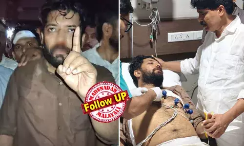 ഷാഫിയുടെ മൂക്കിന്റെ ഇരുവശത്തുമുള്ള അസ്ഥികള്‍ക്ക് പൊട്ടല്‍; സി ടി സ്‌കാന്‍ റിപ്പോര്‍ട്ടിലെ വിവരങ്ങള്‍ പങ്കുവച്ച് മെഡിക്കല്‍ ബുളളറ്റിന്‍; ആരോഗ്യ വിവരങ്ങള്‍ തിരക്കി പ്രിയങ്കയുടെ കോള്‍; മര്‍ദ്ദിച്ചിട്ടില്ലെന്ന കോഴിക്കോട് റൂറല്‍ എസ്.പിയുടെ വാദത്തെ ഖണ്ഡിക്കുന്ന ദൃശ്യങ്ങള്‍ പുറത്ത്; സംസ്ഥാന വ്യാപകമായ കോണ്‍ഗ്രസ് പ്രതിഷേധത്തില്‍ സംഘര്‍ഷം