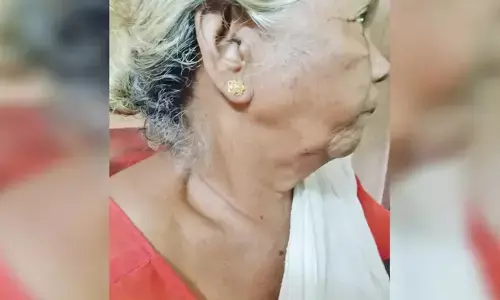 വരവുമാല ഇട്ടിട്ടും രക്ഷയില്ല; കള്ളന്റെ പിടിവലിയില്‍ വയോധികയുടെ കഴുത്തിന് പരിക്ക്