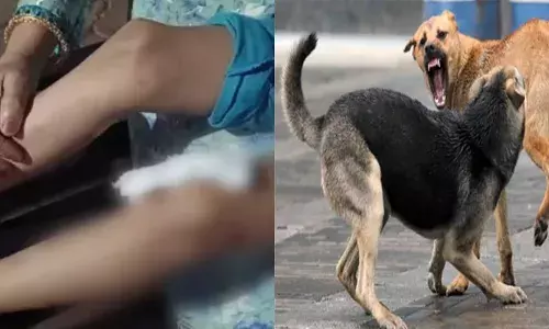 ലഞ്ച് ബ്രേക്കിനിടെ സ്‌കൂൾ ഗേറ്റിനടുത്തേക്ക് വന്നു; പൊടുന്നനെ തെരുവുനായ ആക്രമണം; ഒന്നാം ക്ലാസുകാരന്റെ കാലിന് പരിക്ക്; ആശുപത്രിയിൽ പ്രവേശിപ്പിച്ചു