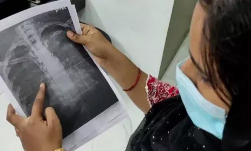 നെഞ്ചിൽ ഗൈഡ് വയര്‍ കുടുങ്ങിയെന്ന യുവതിയുടെ പരാതിയിൽ ഒടുവിൽ നടപടി; പ്രത്യേക മെഡിക്കൽ ബോർഡ് രൂപീകരിക്കാൻ നീക്കം; ശസ്ത്രക്രിയ നടത്തിയ ഡോക്ടറുടെ അടക്കം മൊഴി എടുത്ത് പോലീസ്