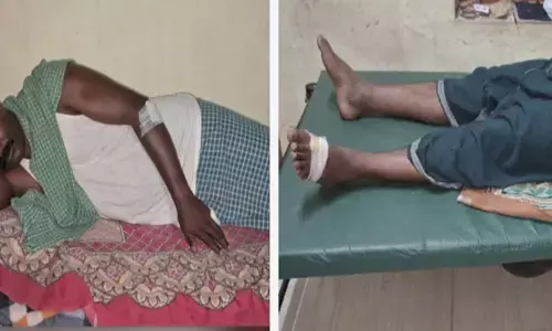 ഡ്യൂട്ടിക്കിടയിൽ ഭക്ഷണം കഴിക്കാൻ ഇറങ്ങി; ബൈക്കിൽ റോഡിലൂടെ പോകുന്നതിനിടെ കാട്ടുപന്നി ആക്രമണം; നിലവിളി കേട്ട് നാട്ടുകാർ ഓടിയെത്തി; ജീവനക്കാരുടെ തലയിലും വയറിലും പരിക്ക്