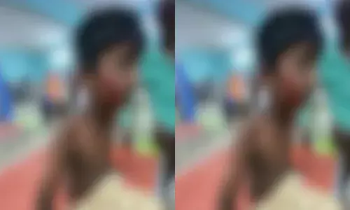 വീടിനു സമീപത്ത് കളിക്കുന്നതിനിടെ തെരുവുനായ ആക്രമണം; രണ്ടാം ക്ലാസുകാരനെ കടിച്ചുപറിച്ചു; പ്രദേശവാസിയായ യുവതിക്കും പരിക്ക്; സംഭവം പാലക്കാട്