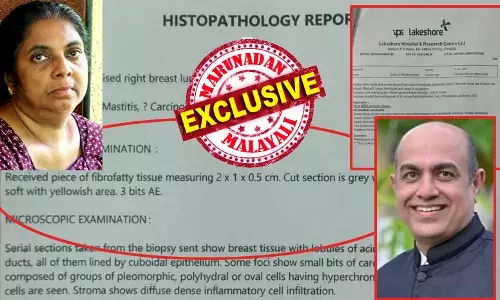 ജീവയിലെ ബയോപ്‌സിയില്‍ ക്യാന്‍സര്‍; ആ റിപ്പോര്‍ട്ട് കണ്ടതും ഗംഗാധരന്‍ ഡോക്ടര്‍ ഉപദേശിച്ചത് മറ്റൊരു ബയോപ്‌സി പരിശോധനയ്ക്ക് ശേഷമുള്ള ശസ്ത്രക്രിയ; ലേക്ഷോറില്‍ നിന്നും റിപ്പോര്‍ട്ട് 13ന് കിട്ടി; ക്യാന്‍സറില്ലെന്ന് തെളിഞ്ഞ ആ റിപ്പോര്‍ട്ട് കൈയ്യില്‍ പിടിച്ച് 17ന് ശസ്ത്രക്രിയ; മറുനാടനെ കളങ്കപ്പെടുത്താന്‍ സോഷ്യല്‍ മീഡിയയില്‍ ഇട്ടത് ആദ്യത്തെ തെറ്റായ റിപ്പോര്‍ട്ടും; ഡോക്ടര്‍മാരിലും മുരാരി ബാബു! ഡോ ജോജോ വി ജോസഫിന്റേത് പിഴവ് തന്നെ