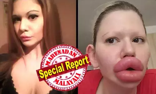 ചെറുപ്പം മുതലേ വ്യത്യസ്തത ഇഷ്ടപ്പെട്ടിരുന്നു..; ചുണ്ടുകളിൽ കുത്തിവെച്ചത് 32 ആസിഡ് സിറിഞ്ചുകൾ; ലോകത്തിലെ ഏറ്റവും വലിയ ചുണ്ടുകൾ സ്വന്തമാക്കാൻ മുടക്കിയത് 23 ലക്ഷം രൂപ; ചിത്രങ്ങൾ വൈറലായതോടെ കമന്റ് ബോക്സ് നിറഞ്ഞു; മൈ ബോഡി, മൈ റൂൾസെന്ന് മറുപടി