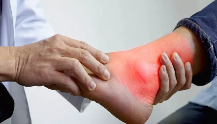 ചില സമയം കടുത്ത നടുവേദനയ്ക്കും കാരണമാകാം...; യൂറിക് ആസിഡ് കൂടുമ്പോള് ഉണ്ടാകുന്ന ആരോഗ്യ പ്രശ്നങ്ങൾ എന്തൊക്കെ?; അറിയാം... ചില സമയം കടുത്ത നടുവേദനയ്ക്കും കാരണമാകാം...; യൂറിക് ആസിഡ് കൂടുമ്പോള് ഉണ്ടാകുന്ന ആരോഗ്യ പ്രശ്നങ്ങൾ എന്തൊക്കെ?; അറിയാം...