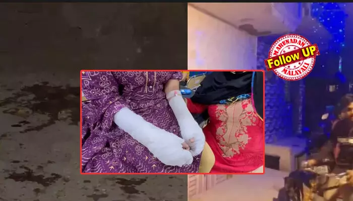 വിദ്യാര്ഥിനിയുടെ കൈയ്യിലും വയറിലും മനപ്പൂര്വം പൊള്ളലേല്പ്പിച്ചതോ? ഡല്ഹി ആസിഡ് ആക്രമണത്തില് വമ്പന് ട്വിസ്റ്റ്;   യുവാവിനെ കേസില് പെടുത്താന് നടത്തിയ നാടകം; പിതാവ് അറസ്റ്റില്;  പെണ്കുട്ടിക്കെതിരെയും കേസെടുത്തേക്കും വിദ്യാര്ഥിനിയുടെ കൈയ്യിലും വയറിലും മനപ്പൂര്വം പൊള്ളലേല്പ്പിച്ചതോ? ഡല്ഹി ആസിഡ് ആക്രമണത്തില് വമ്പന് ട്വിസ്റ്റ്;   യുവാവിനെ കേസില് പെടുത്താന് നടത്തിയ നാടകം; പിതാവ് അറസ്റ്റില്;  പെണ്കുട്ടിക്കെതിരെയും കേസെടുത്തേക്കും