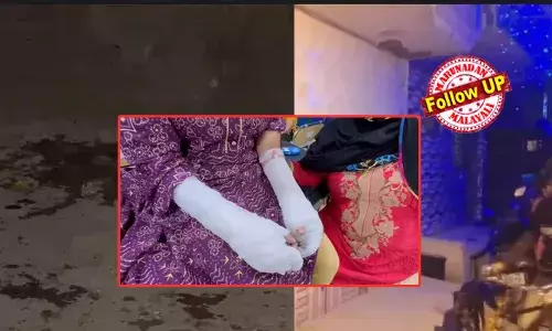 വിദ്യാര്‍ഥിനിയുടെ കൈയ്യിലും വയറിലും മനപ്പൂര്‍വം പൊള്ളലേല്‍പ്പിച്ചതോ? ഡല്‍ഹി ആസിഡ് ആക്രമണത്തില്‍ വമ്പന്‍ ട്വിസ്റ്റ്;   യുവാവിനെ കേസില്‍ പെടുത്താന്‍ നടത്തിയ നാടകം; പിതാവ് അറസ്റ്റില്‍;  പെണ്‍കുട്ടിക്കെതിരെയും കേസെടുത്തേക്കും