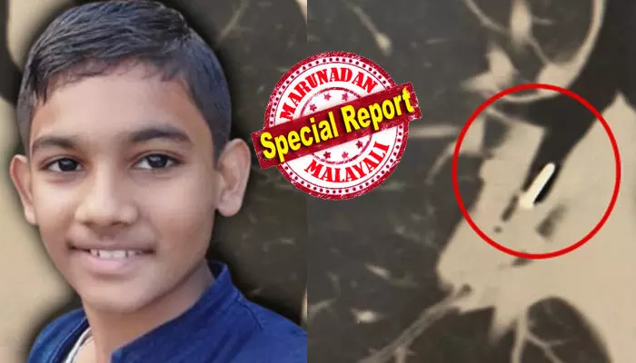 സ്കൂൾ വിട്ട് വീട്ടിലെത്തിയ കുട്ടിക്ക് ഭയങ്കര വയറുവേദന; സഹിക്കാൻ കഴിയാതെ വന്നതോടെ ആശുപത്രിയിൽ പ്രവേശിപ്പിച്ചു; എക്സ്റേ പരിശോധനയിൽ ഡോക്ടർമാർക്ക് അമ്പരപ്പ്; ഏഴാം ക്ലാസുകാരന്റെ ജീവനെടുത്തത് ആ പിൻ; കണ്ണീരോടെ ഉറ്റവർ സ്കൂൾ വിട്ട് വീട്ടിലെത്തിയ കുട്ടിക്ക് ഭയങ്കര വയറുവേദന; സഹിക്കാൻ കഴിയാതെ വന്നതോടെ ആശുപത്രിയിൽ പ്രവേശിപ്പിച്ചു; എക്സ്റേ പരിശോധനയിൽ ഡോക്ടർമാർക്ക് അമ്പരപ്പ്; ഏഴാം ക്ലാസുകാരന്റെ ജീവനെടുത്തത് ആ പിൻ; കണ്ണീരോടെ ഉറ്റവർ