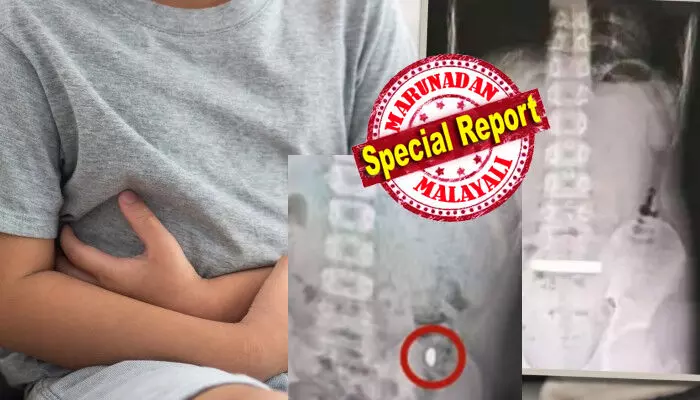 അമ്മേ...ഞാൻ ഇപ്പോൾ മരിക്കും എന്നെ രക്ഷിക്കുവെന്ന് അലറിവിളിച്ച് കൊണ്ട് ഓടിയെത്തിയ മകൻ; വിഴുങ്ങിയ ആ ബീൻ രൂപത്തിലുള്ള വസ്തു എത്ര നോക്കിയിട്ടും പുറത്തെടുക്കാൻ സാധിച്ചില്ല; മലത്തിലൂടെ പോകുമെന്ന് കരുതി അതും നടന്നില്ല; ഒടുവിൽ ആശുപത്രിയിൽ കൊണ്ടുപോയപ്പോൾ ഡോക്ടർ കണ്ടത്; എല്ലാത്തിനും കാരണം അതിരുവിട്ട പരീക്ഷണം അമ്മേ...ഞാൻ ഇപ്പോൾ മരിക്കും എന്നെ രക്ഷിക്കുവെന്ന് അലറിവിളിച്ച് കൊണ്ട് ഓടിയെത്തിയ മകൻ; വിഴുങ്ങിയ ആ ബീൻ രൂപത്തിലുള്ള വസ്തു എത്ര നോക്കിയിട്ടും പുറത്തെടുക്കാൻ സാധിച്ചില്ല; മലത്തിലൂടെ പോകുമെന്ന് കരുതി അതും നടന്നില്ല; ഒടുവിൽ ആശുപത്രിയിൽ കൊണ്ടുപോയപ്പോൾ ഡോക്ടർ കണ്ടത്; എല്ലാത്തിനും കാരണം അതിരുവിട്ട പരീക്ഷണം