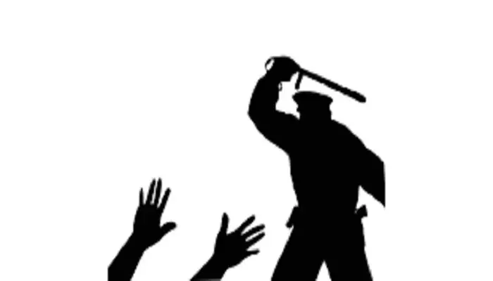 പള്ളിപ്പെരുന്നാൾ സ്ഥലത്ത് വെറുതെ സംസാരിച്ചിരുന്ന യുവാക്കളെ പോലീസ് തല്ലിച്ചതച്ചതായി പരാതി; അഞ്ച്‌ പേർക്ക് പരിക്കേറ്റതായി ആരോപണം; സംഭവം തൃശൂരിൽ