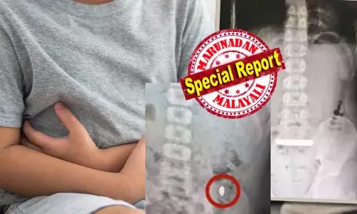 അമ്മേ...ഞാൻ ഇപ്പോൾ മരിക്കും എന്നെ രക്ഷിക്കുവെന്ന് അലറിവിളിച്ച് കൊണ്ട് ഓടിയെത്തിയ മകൻ; വിഴുങ്ങിയ ആ ബീൻ രൂപത്തിലുള്ള വസ്തു എത്ര നോക്കിയിട്ടും പുറത്തെടുക്കാൻ സാധിച്ചില്ല; മലത്തിലൂടെ പോകുമെന്ന് കരുതി അതും നടന്നില്ല; ഒടുവിൽ ആശുപത്രിയിൽ കൊണ്ടുപോയപ്പോൾ ഡോക്ടർ കണ്ടത്; എല്ലാത്തിനും കാരണം അതിരുവിട്ട പരീക്ഷണം