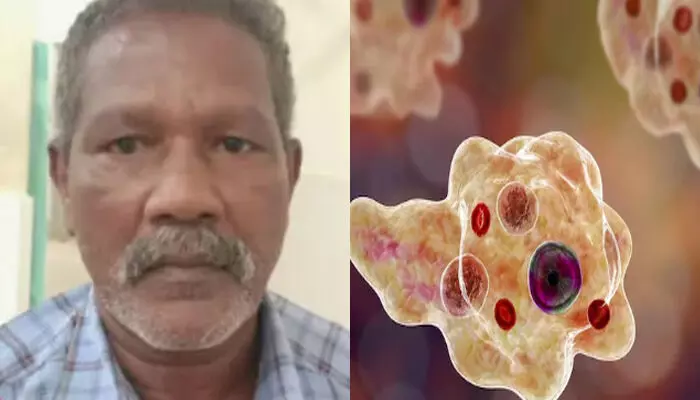 കാലിന് പരിക്കേറ്റ് ചികിത്സയ്ക്കെത്തി; പിന്നാലെ നടത്തിയ പരിശോധനയിൽ ഞെട്ടൽ; സംസ്ഥാനത്ത് അമീബിക് മസ്തിഷ്ക ജ്വരം ബാധിച്ച് ഒരാൾ കൂടി മരിച്ചു; രോഗ ഉറവിടം കണ്ടെത്താനാകാതെ അധികൃതർ കാലിന് പരിക്കേറ്റ് ചികിത്സയ്ക്കെത്തി; പിന്നാലെ നടത്തിയ പരിശോധനയിൽ ഞെട്ടൽ; സംസ്ഥാനത്ത് അമീബിക് മസ്തിഷ്ക ജ്വരം ബാധിച്ച് ഒരാൾ കൂടി മരിച്ചു; രോഗ ഉറവിടം കണ്ടെത്താനാകാതെ അധികൃതർ