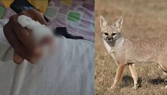 വടകരയില് കുറുനരി യുവാവിന്റെ കൈവിരല് കടിച്ചെടുത്തു; ആറ് വയസുകാരിയടക്കം മൂന്ന് പേര്ക്ക് പരിക്ക് വടകരയില് കുറുനരി യുവാവിന്റെ കൈവിരല് കടിച്ചെടുത്തു; ആറ് വയസുകാരിയടക്കം മൂന്ന് പേര്ക്ക് പരിക്ക്