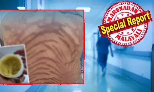 ഓൺലൈനിൽ വാങ്ങിയ സ്കിൻ ക്രീം ഉപയോഗിച്ച യുവതിക്ക് ഗുരുതര ആരോഗ്യപ്രശ്നങ്ങൾ; ശരീരത്തിൽ പ്രത്യക്ഷപ്പെട്ടത് പാമ്പുകളുടെ ചർമ്മത്തിന് സമാനമായ വരകൾ; ചൈനീസ് പരമ്പരാഗത മരുന്ന് എന്ന പേരിൽ വിറ്റിരുന്ന ക്രീമിനായി ചെലവാക്കിയത് 12 ലക്ഷത്തിലേറെ; കാരണം കണ്ടെത്തി ഡോക്ടർമാർ