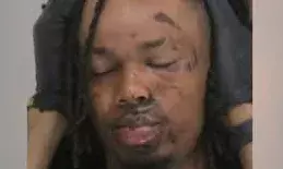 ഡാലസ് ഏരിയ റാപ്പിഡ് ട്രാന്സിറ്റ് ട്രെയിനില് വെടിവയ്പ്പിന് 18 വയസ്സുള്ള പ്രതി അറസ്റ്റില് ഡാലസ് ഏരിയ റാപ്പിഡ് ട്രാന്സിറ്റ് ട്രെയിനില് വെടിവയ്പ്പിന് 18 വയസ്സുള്ള പ്രതി അറസ്റ്റില്