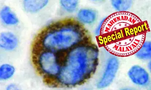 ഉമിനീരിലൂടെ പടരുന്ന ചുംബന രോഗം; ലോകജനസംഖ്യയുടെ 95% പേരെയും ബാധിക്കുന്ന വൈറസ് വിനാശകരമായ ഓട്ടോ ഇമ്മ്യൂണ്‍ അവസ്ഥകള്‍ക്ക് കാരണമാകും; കരുതലെടുക്കാന്‍ ഇത്ാ ഒരു ആരോഗ്യ പഠന റിപ്പോര്‍ട്ട്