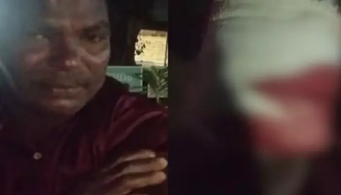 നൂറ് രൂപയെ ചൊല്ലിയുള്ള തർക്കം; പിന്നാലെ മുട്ടൻ ഇടി; കോഴിക്കോട് യുവാവിന് കുത്തേറ്റു; പോലീസ് അന്വേഷണം തുടങ്ങി നൂറ് രൂപയെ ചൊല്ലിയുള്ള തർക്കം; പിന്നാലെ മുട്ടൻ ഇടി; കോഴിക്കോട് യുവാവിന് കുത്തേറ്റു; പോലീസ് അന്വേഷണം തുടങ്ങി