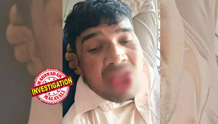 വിവാഹം കഴിച്ചിട്ടും മുന്‍ കാമുകിയുമായി അടുപ്പം;   യുവതിയുടെ വിവാഹം ഉറപ്പിച്ചിട്ടും പിന്തുടര്‍ന്ന് ശല്യം ചെയ്ത് 35കാരന്‍; തനിച്ചായ സമയത്ത് കെട്ടിപ്പിടിച്ച് ചുംബിക്കാന്‍ ശ്രമം; യുവാവിന്റെ നാക്ക് കടിച്ചു മുറിച്ച് പ്രതികാരം; നിലവിളി കേട്ട് ഓടിയെത്തിയ നാട്ടുകാര്‍ കണ്ടത്