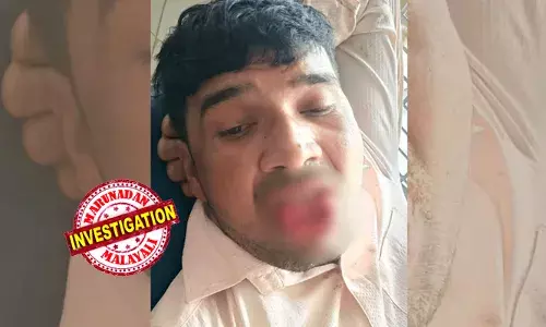 വിവാഹം കഴിച്ചിട്ടും മുന്‍ കാമുകിയുമായി അടുപ്പം;   യുവതിയുടെ വിവാഹം ഉറപ്പിച്ചിട്ടും പിന്തുടര്‍ന്ന് ശല്യം ചെയ്ത് 35കാരന്‍; തനിച്ചായ സമയത്ത് കെട്ടിപ്പിടിച്ച് ചുംബിക്കാന്‍ ശ്രമം; യുവാവിന്റെ നാക്ക് കടിച്ചു മുറിച്ച് പ്രതികാരം; നിലവിളി കേട്ട് ഓടിയെത്തിയ നാട്ടുകാര്‍ കണ്ടത്