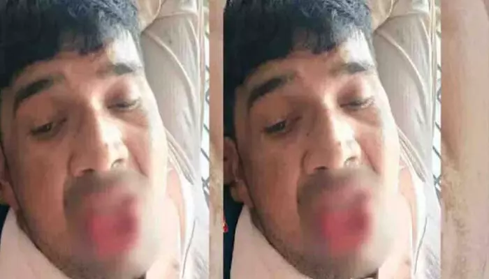 മുന്‍ കാമുകിയെ ബലംപ്രയോഗിച്ച് ചുംബിച്ചു; യുവാവിന്റെ നാക്കു കടിച്ച് മുറിച്ച് യുവതി