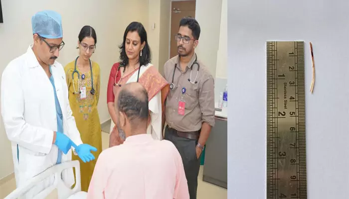 വിട്ടുമാറാത്ത ചുമയും പനിയും; സ്കാനില് കരളില് തറച്ച നിലയില് മീന്മുള്ള്; ശസ്ത്രക്രിയയിലൂടെ നീക്കം ചെയ്തതോടെ 36 കാരന് ആശ്വാസം; ഒഴിവായത് ജീവന് പോലും ഭീഷണിയാകുന്ന കരളിലെ പഴുപ്പ് വിട്ടുമാറാത്ത ചുമയും പനിയും; സ്കാനില് കരളില് തറച്ച നിലയില് മീന്മുള്ള്; ശസ്ത്രക്രിയയിലൂടെ നീക്കം ചെയ്തതോടെ 36 കാരന് ആശ്വാസം; ഒഴിവായത് ജീവന് പോലും ഭീഷണിയാകുന്ന കരളിലെ പഴുപ്പ്