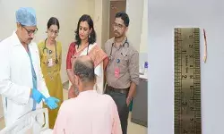 വിട്ടുമാറാത്ത ചുമയും പനിയും; സ്‌കാനില്‍ കരളില്‍ തറച്ച നിലയില്‍ മീന്‍മുള്ള്; ശസ്ത്രക്രിയയിലൂടെ നീക്കം ചെയ്തതോടെ 36 കാരന് ആശ്വാസം; ഒഴിവായത് ജീവന് പോലും ഭീഷണിയാകുന്ന കരളിലെ പഴുപ്പ്