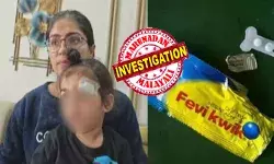 മേശയുടെ വക്കിൽ തലയിടിച്ചുണ്ടായ മാരക മുറിവ്; ഭീതിപ്പെടുത്തുന്ന രീതിയിൽ ചോരയൊഴുകുന്ന മകനെയും വാരിപ്പുണർന്ന് ആശുപത്രിയിലേക്ക് ഓടിയെത്തി ആ അമ്മ; കുട്ടിയുടെ പരിക്ക് കണ്ടതും ഡോക്ടറുടെ ഫെവിക്വിക് പ്രയോഗം; വിചിത്ര പ്രവർത്തിയിൽ നാട്ടുകാർക്ക് ഞെട്ടൽ; വ്യാപക പ്രതിഷേധം