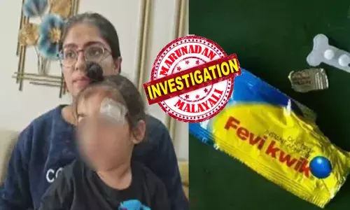 മേശയുടെ വക്കിൽ തലയിടിച്ചുണ്ടായ മാരക മുറിവ്; ഭീതിപ്പെടുത്തുന്ന രീതിയിൽ ചോരയൊഴുകുന്ന മകനെയും വാരിപ്പുണർന്ന് ആശുപത്രിയിലേക്ക് ഓടിയെത്തി ആ അമ്മ; കുട്ടിയുടെ പരിക്ക് കണ്ടതും ഡോക്ടറുടെ ഫെവിക്വിക് പ്രയോഗം; വിചിത്ര പ്രവർത്തിയിൽ നാട്ടുകാർക്ക് ഞെട്ടൽ; വ്യാപക പ്രതിഷേധം മേശയുടെ വക്കിൽ തലയിടിച്ചുണ്ടായ മാരക മുറിവ്; ഭീതിപ്പെടുത്തുന്ന രീതിയിൽ ചോരയൊഴുകുന്ന മകനെയും വാരിപ്പുണർന്ന് ആശുപത്രിയിലേക്ക് ഓടിയെത്തി ആ അമ്മ; കുട്ടിയുടെ പരിക്ക് കണ്ടതും ഡോക്ടറുടെ ഫെവിക്വിക് പ്രയോഗം; വിചിത്ര പ്രവർത്തിയിൽ നാട്ടുകാർക്ക് ഞെട്ടൽ; വ്യാപക പ്രതിഷേധം