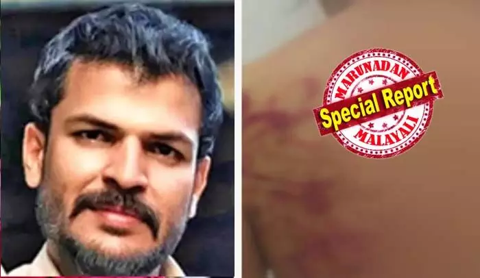 കൊച്ചിയില്‍ പങ്കാളിയെ ക്രൂരമായി മര്‍ദ്ദിച്ച സംഭവം; യുവമോര്‍ച്ച നേതാവ് ഗോപു പരമശിവത്തെ ബിജെപിയുടെ പ്രാഥമിക അംഗത്വത്തില്‍ നിന്ന് പുറത്താക്കി; ഗോപു നിരന്തരം മര്‍ദിക്കാറുണ്ടായിരുന്നെന്നും ചാര്‍ജര്‍ കേബിള്‍ ഉപയോഗിച്ച് മര്‍ദിച്ചു; പുറത്ത് പോകാന്‍ സമ്മതിക്കാതെ വീട്ടില്‍ പൂട്ടിയിടുമെന്നും പങ്കാളിയായ യുവതി