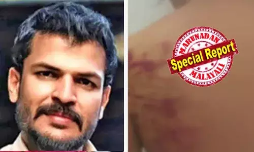 കൊച്ചിയില്‍ പങ്കാളിയെ ക്രൂരമായി മര്‍ദ്ദിച്ച സംഭവം; യുവമോര്‍ച്ച നേതാവ് ഗോപു പരമശിവത്തെ ബിജെപിയുടെ പ്രാഥമിക അംഗത്വത്തില്‍ നിന്ന് പുറത്താക്കി; ഗോപു നിരന്തരം മര്‍ദിക്കാറുണ്ടായിരുന്നെന്നും ചാര്‍ജര്‍ കേബിള്‍ ഉപയോഗിച്ച് മര്‍ദിച്ചു; പുറത്ത് പോകാന്‍ സമ്മതിക്കാതെ വീട്ടില്‍ പൂട്ടിയിടുമെന്നും പങ്കാളിയായ യുവതി