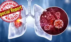 ഡിഎന്എയിലെ മ്യൂട്ടേഷനുകള് കാരണം രൂപപ്പെടുന്ന ട്യൂമര് ആന്റിജനുകളെ വേട്ടയാടി നശിപ്പിക്കും വാക്സിന്; ക്യാന്സറായി മാറുന്നതിന് മുന്പേ തന്നെ അവയെ ഇല്ലാതാക്കും; ശ്വാസകോശാര്ബുദം: മരണത്തെ തടയാന് പുതിയ പ്രതീക്ഷ ഡിഎന്എയിലെ മ്യൂട്ടേഷനുകള് കാരണം രൂപപ്പെടുന്ന ട്യൂമര് ആന്റിജനുകളെ വേട്ടയാടി നശിപ്പിക്കും വാക്സിന്; ക്യാന്സറായി മാറുന്നതിന് മുന്പേ തന്നെ അവയെ ഇല്ലാതാക്കും; ശ്വാസകോശാര്ബുദം: മരണത്തെ തടയാന് പുതിയ പ്രതീക്ഷ