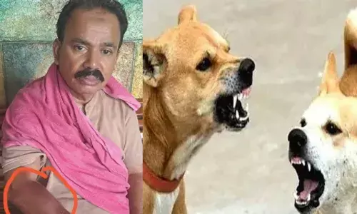 ഒരു കല്യാണത്തിന് പങ്കെടുത്ത് വീട്ടിലേക്ക് മടക്കം; സ്‌കൂട്ടറിന് പിന്നാലെ കടിക്കാൻ ഓടിച്ച് തെരുവ് നായക്കൂട്ടം; റോഡിൽ തെറിച്ചുവീണ് യാത്രക്കാരന് പരിക്ക്; രക്ഷപ്പെട്ടത് ഭാഗ്യം കൊണ്ട്