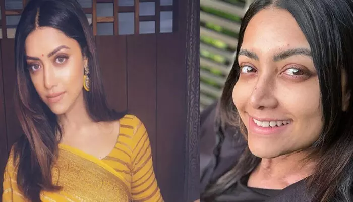 ആ സമയത്ത് എന്റെ ശരീരത്തിന്റെ അവസ്ഥ വളരെ മോശമായി; എന്നിട്ടും ഞാൻ പിടിച്ചു നിന്നു; ഒരു പോയന്റ് കഴിഞ്ഞപ്പോൾ ഓരോരുത്തർ ചോദിച്ചു തുടങ്ങി; തുറന്നുപറഞ്ഞ് നടി മംമ്ത ആ സമയത്ത് എന്റെ ശരീരത്തിന്റെ അവസ്ഥ വളരെ മോശമായി; എന്നിട്ടും ഞാൻ പിടിച്ചു നിന്നു; ഒരു പോയന്റ് കഴിഞ്ഞപ്പോൾ ഓരോരുത്തർ ചോദിച്ചു തുടങ്ങി; തുറന്നുപറഞ്ഞ് നടി മംമ്ത