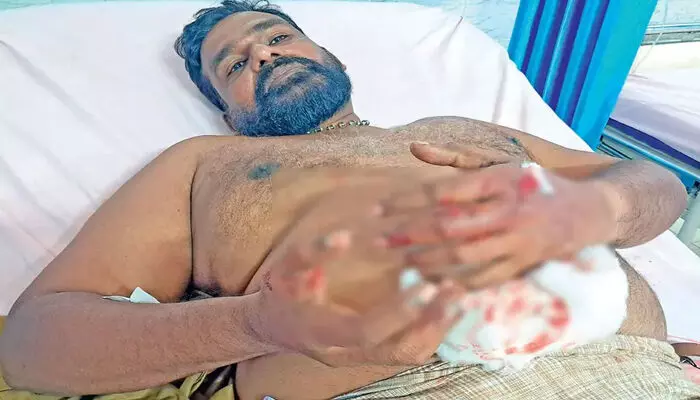 റോഡിനു കുറുകേ ചാടിയ തെരുവുനായയെ ഇടിച്ച് ഓട്ടോ മറിഞ്ഞു; ഓട്ടോയ്ക്കുള്ളില്‍ കുടുങ്ങിയ നായയുടെ കടിയേറ്റ് ഡ്രൈവര്‍ക്ക് ഗുരുതര പരിക്ക്