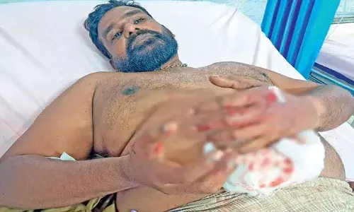 റോഡിനു കുറുകേ ചാടിയ തെരുവുനായയെ ഇടിച്ച് ഓട്ടോ മറിഞ്ഞു; ഓട്ടോയ്ക്കുള്ളില്‍ കുടുങ്ങിയ നായയുടെ കടിയേറ്റ് ഡ്രൈവര്‍ക്ക് ഗുരുതര പരിക്ക്