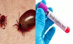 പ്രദേശത്തെ ഒരു കുട്ടി മരിച്ചതോടെ മുഴുവൻ പരിഭ്രാന്തി; രോഗികളെ കൊണ്ട് നിറഞ്ഞ് ആശുപത്രികൾ; ആന്ധ്രയെ വിറപ്പിച്ച് ചെള്ളുപനി വ്യാപനം; മരണസംഖ്യ എട്ടായി ഉയർന്നു; അതീവ ജാഗ്രത പ്രദേശത്തെ ഒരു കുട്ടി മരിച്ചതോടെ മുഴുവൻ പരിഭ്രാന്തി; രോഗികളെ കൊണ്ട് നിറഞ്ഞ് ആശുപത്രികൾ; ആന്ധ്രയെ വിറപ്പിച്ച് ചെള്ളുപനി വ്യാപനം; മരണസംഖ്യ എട്ടായി ഉയർന്നു; അതീവ ജാഗ്രത